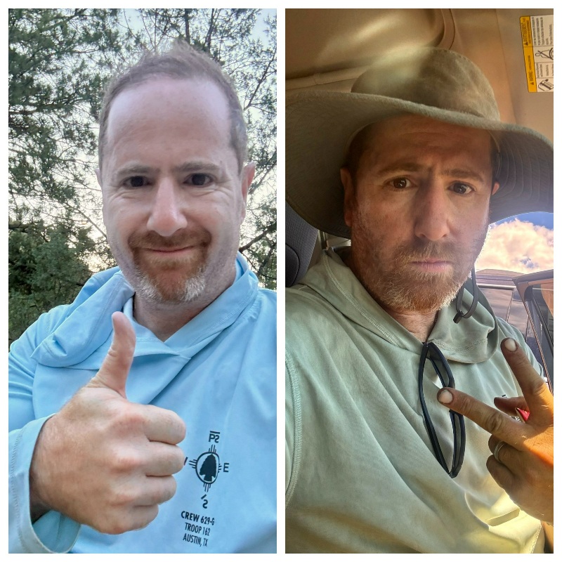 philmont before and after